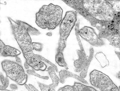 Mumps (microscope)